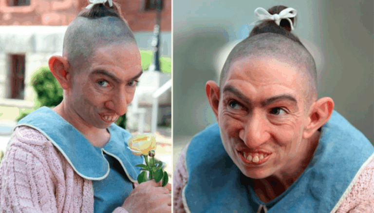 She Let Herself Be Disfigured For A Role In A TV Series. Here’s What She Looks Like In Real Life!