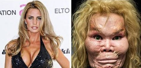 Famous Celebrities Who Spent Millions Transforming Their Appearance😱