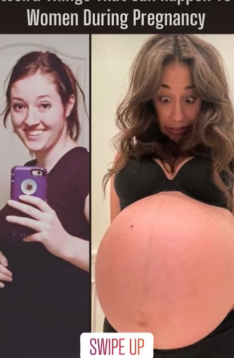 Weird Pregnancy Symptoms That May Signal Hormonal Imbalance, Gestational Diabetes, or High-Risk Complications