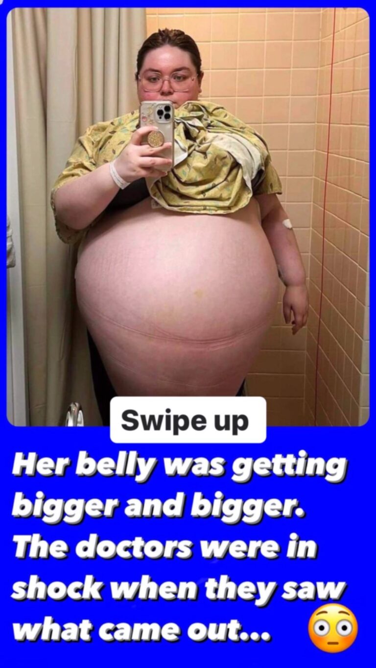 ‘It felt like my organs were being crushed,’ said a 20-year-old woman from Florida after having a 100-pound ovarian cyst