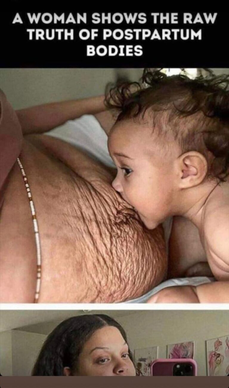Moms Get Brutally Honest About Post-Baby Bodies — And Fans Are Cheering