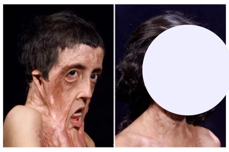 This girl’s miracle story will make you surprised… Know more below…