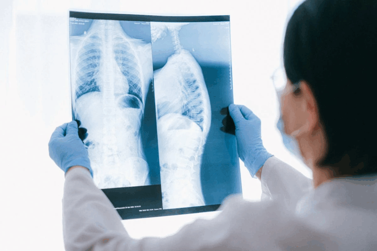 Doctors Stunned After Young Dad Dies With 72 Holes Found In His Lungs